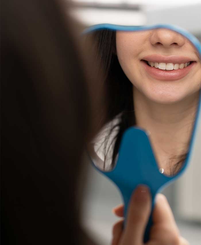 Bonding-and-follow-up Porcelain Veneers in Toronto